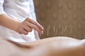 acupunctuur opleiding voor artsen