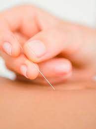 acupunctuur en zwangerschap