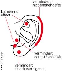 acupunctuur stoppen met roken