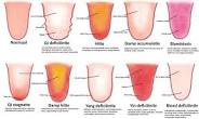 tongdiagnose