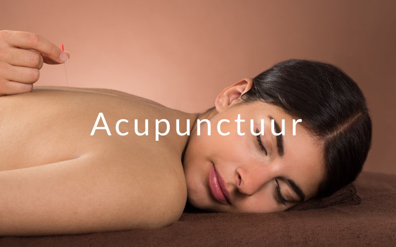china acupunctuur