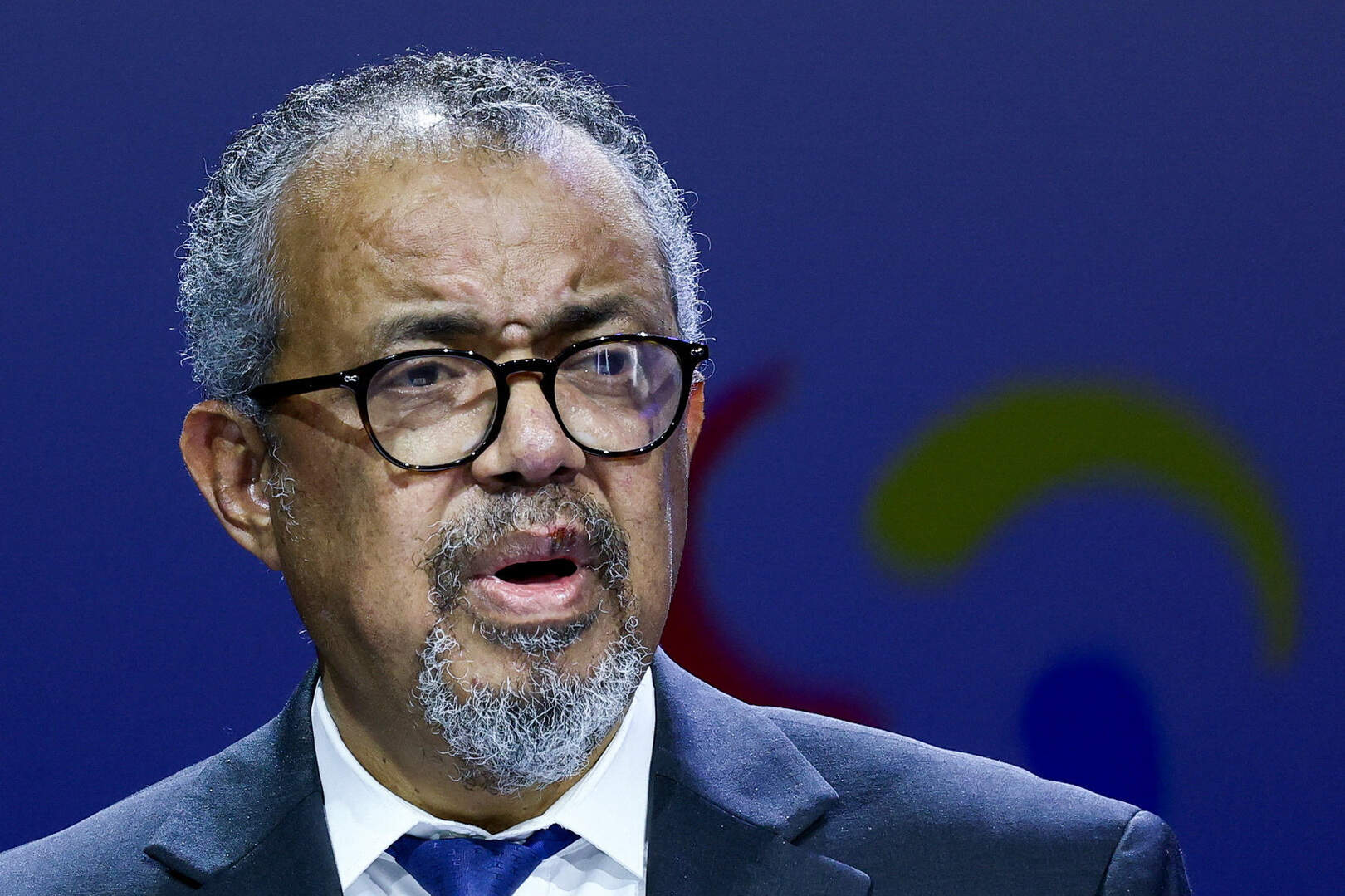 wereldgezondheidsorganisatie