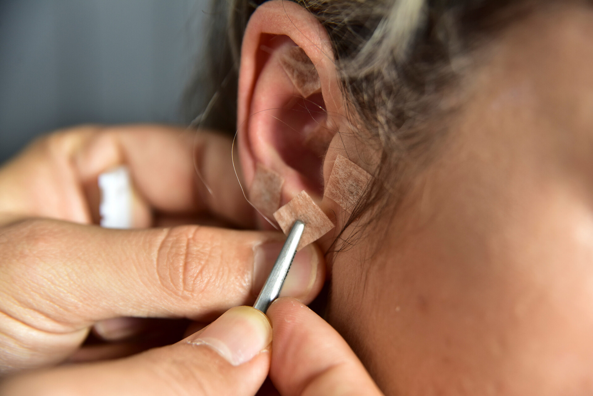 acupunctuurpunten in het oor