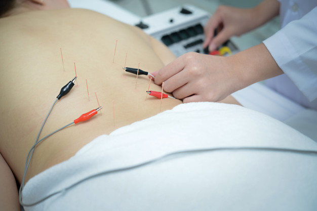 bijwerkingen acupunctuur